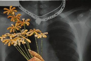 Matthew Cox: Embroidered X-Rays